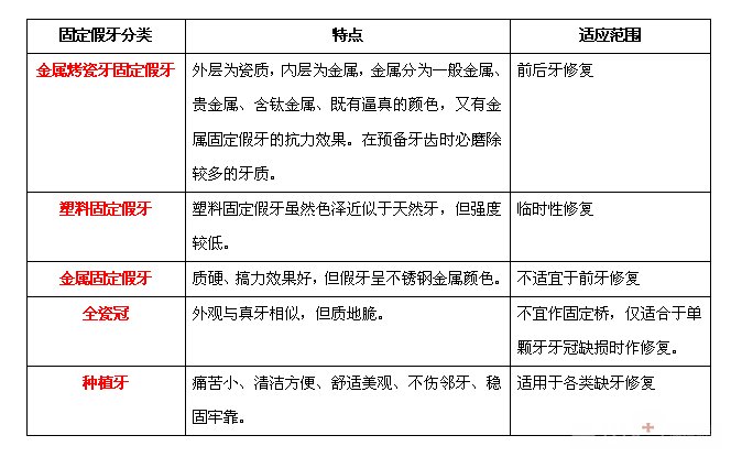 固定假牙的种类有哪些