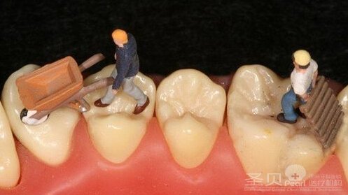 成都牙齿缺失用哪些修复方法好