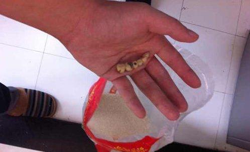 米饭里吃出一排假牙 背后真相何在