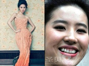 一口牙毁掉一张脸 刘亦菲也难幸免