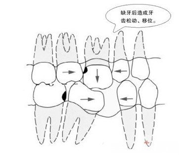 再见C罗 再见我的牙