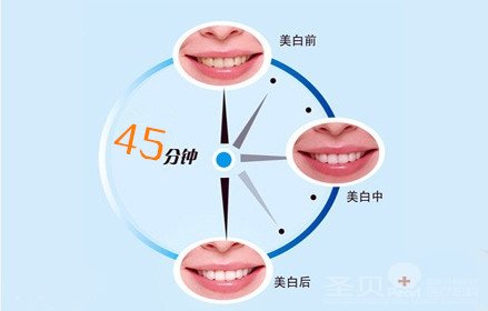 成都冠修复效果好不好
