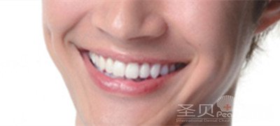 做冠我们应该注意意哪些问题