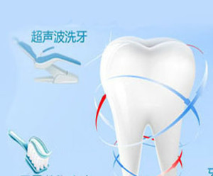 牙结石如何清除