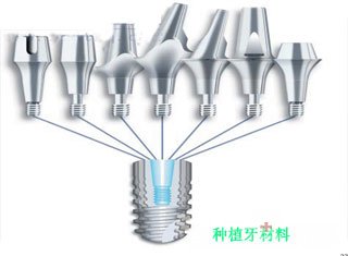 成都种植一颗牙多少钱2