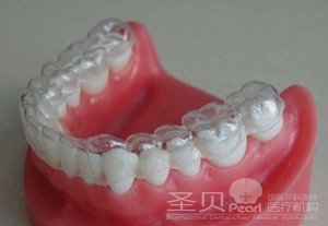 隐形牙齿矫正多少钱