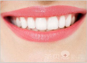 牙齿美白的价格贵不贵3