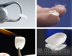 有了烟渍牙如何美白2