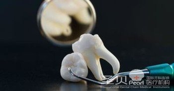 成都微痛拔牙与传统拔牙有何区别
