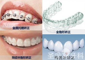 牙缝大怎么办 方法决定效果3