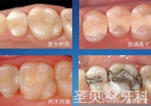 补牙全攻略——技术篇2