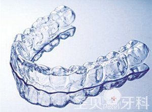 正畸告诉你 牙齿矫正哪种方法好2