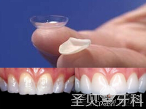 抽烟导致牙齿变黑怎么办 美白方法多3